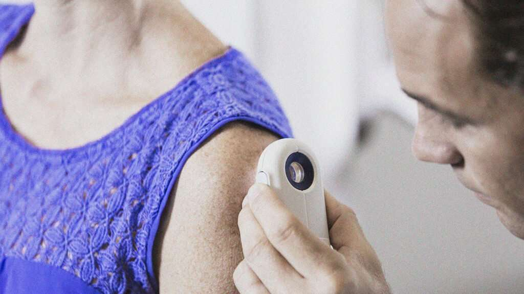 Does Medicare Cover Skin Cancer Removal HealthySkinWorld